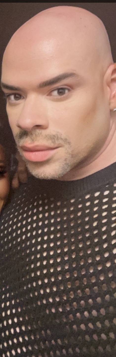 Bald person with light skin and facial hair wearing a black, textured shirt.