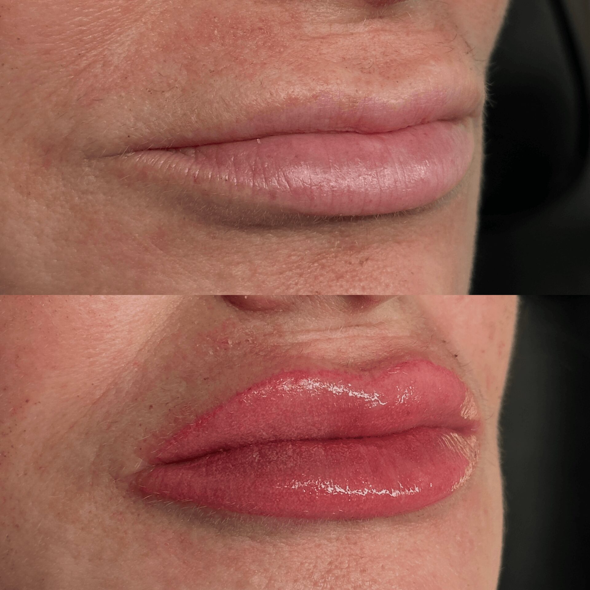 Close-up of lips, showing natural and glossed lips with skin texture and some small blemishes.