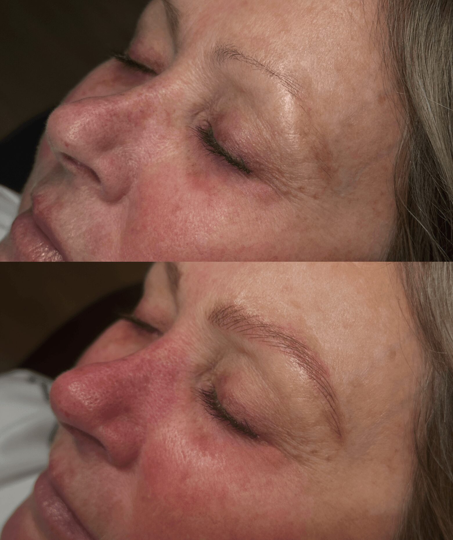 Close-up of a woman's face before and after skincare, showing improved skin texture and reduced redness.