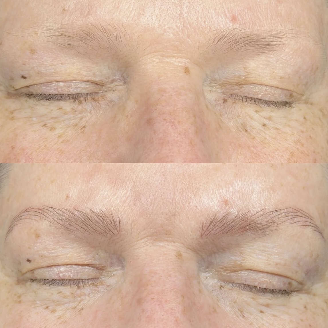 Close-up of closed eyes showing skin with wrinkles and age spots, before and after skincare or treatment.