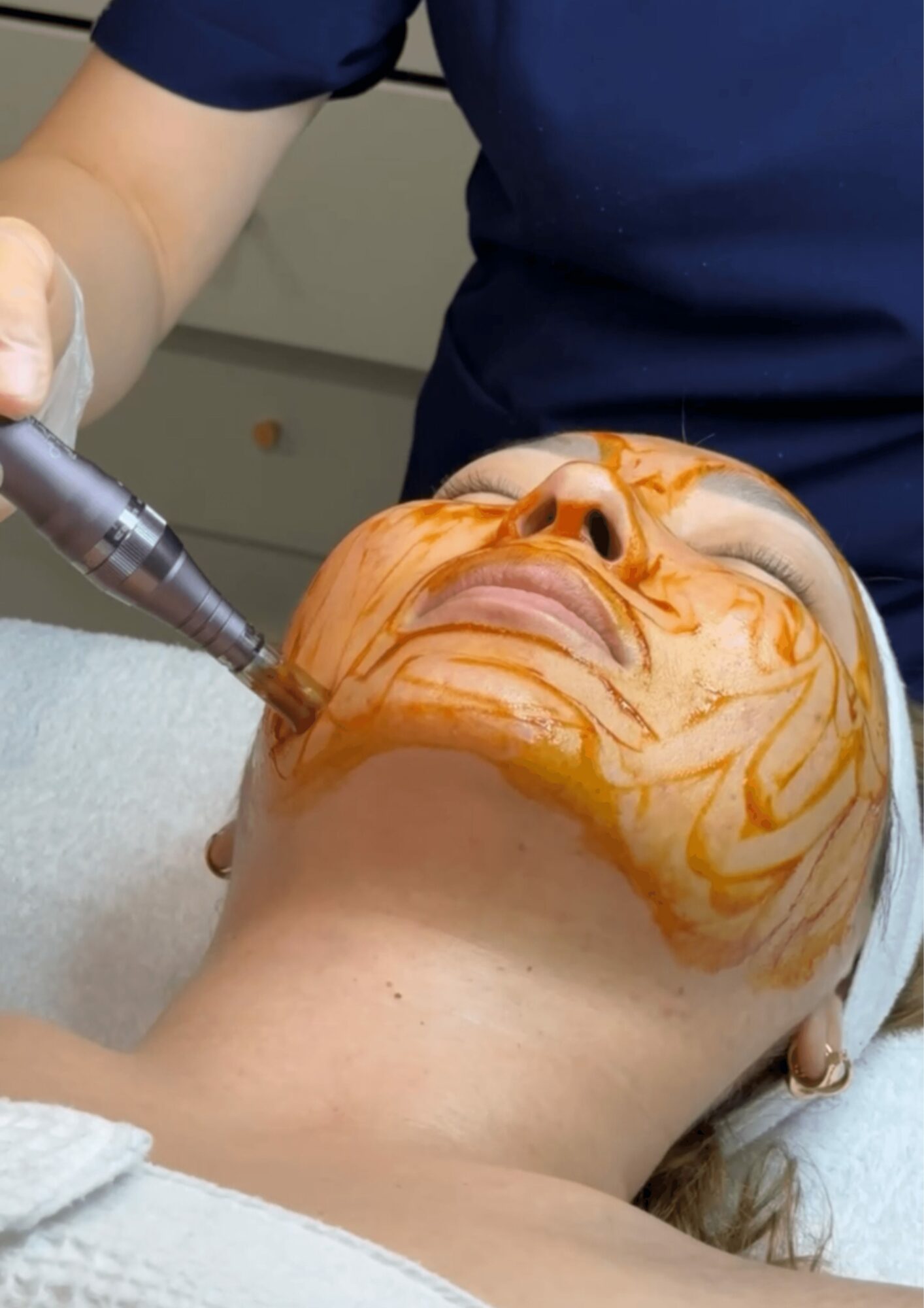 Person lying down with face covered in orange facial mask, receiving treatment from a professional.