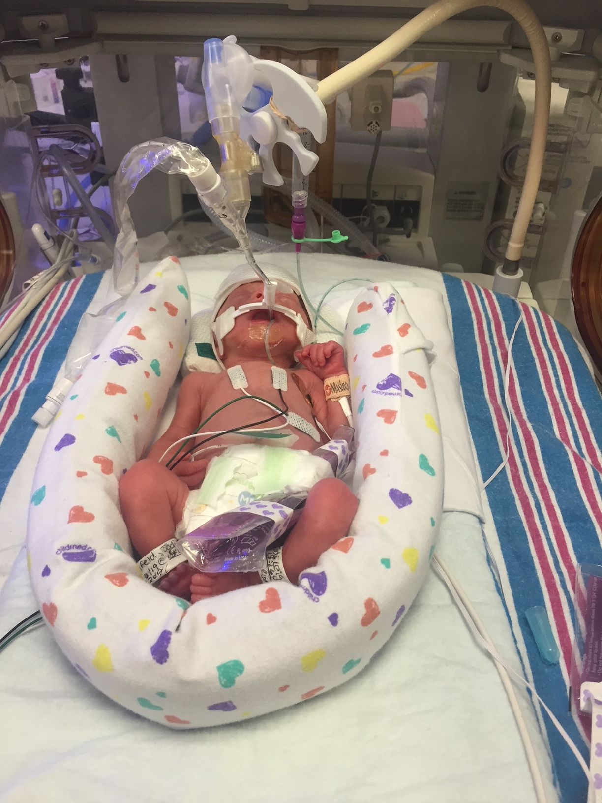 Newborn baby in incubator with medical tubes and wires, lying on a colorful blanket in hospital setting.