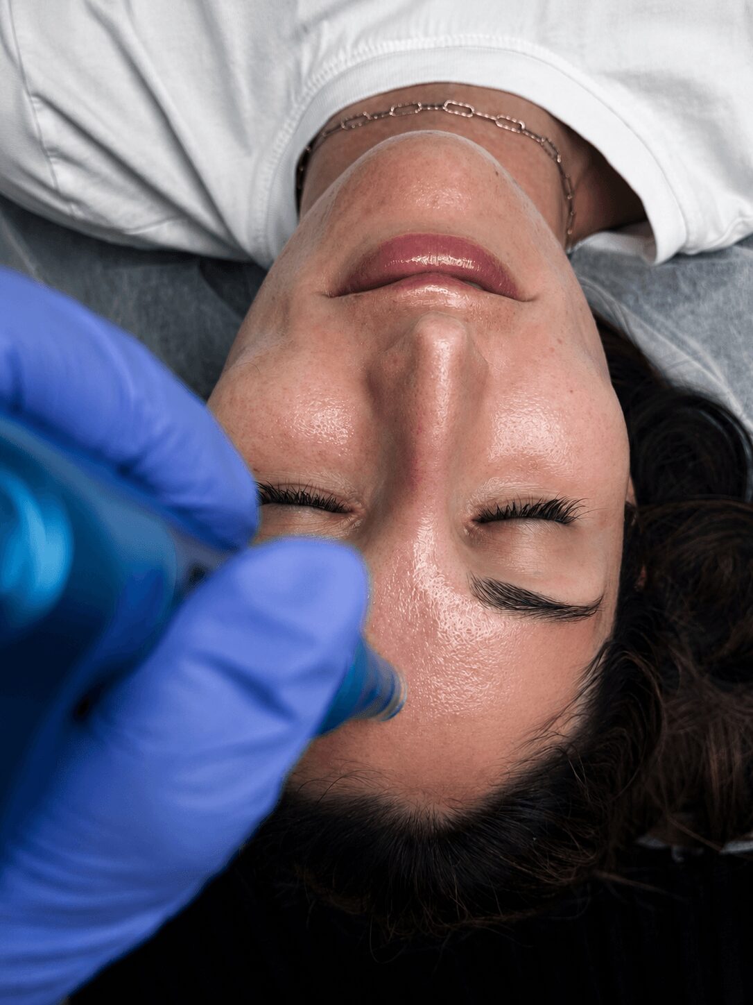 Woman lying down with eyes closed, receiving a facial treatment, with a gloved hand near her face.