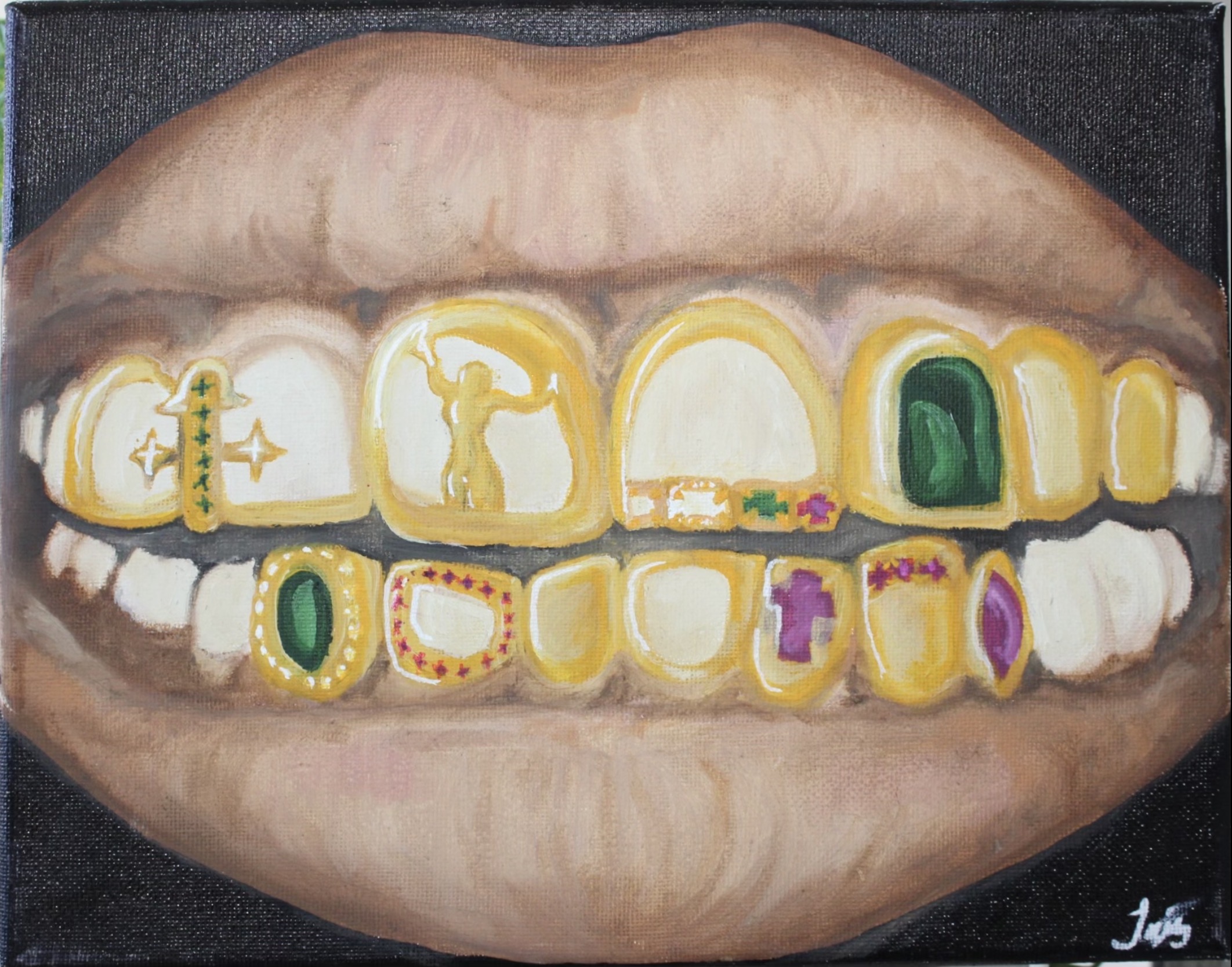 Close-up of lips with gold and colorful dental jewelry on teeth, against a dark background.