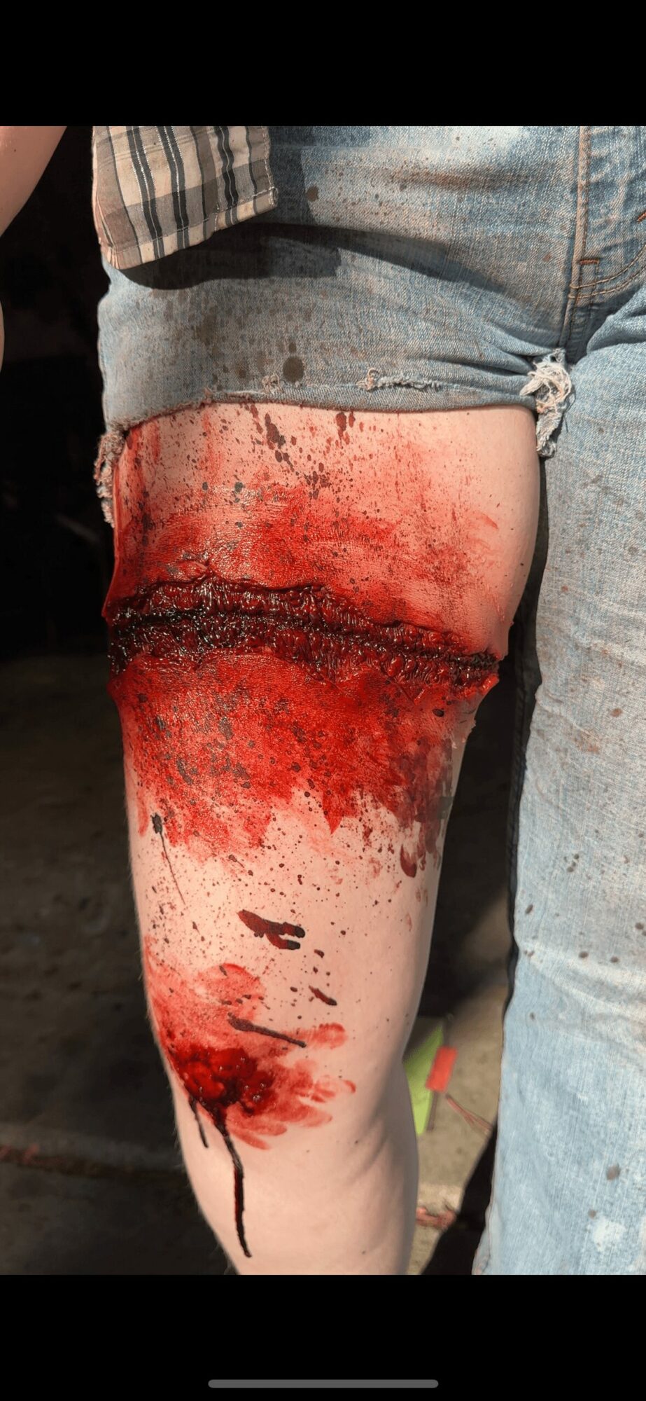 A person's thigh with a large, bloody, and bruised wound, with blood and dark marks, partially covered by denim shorts.