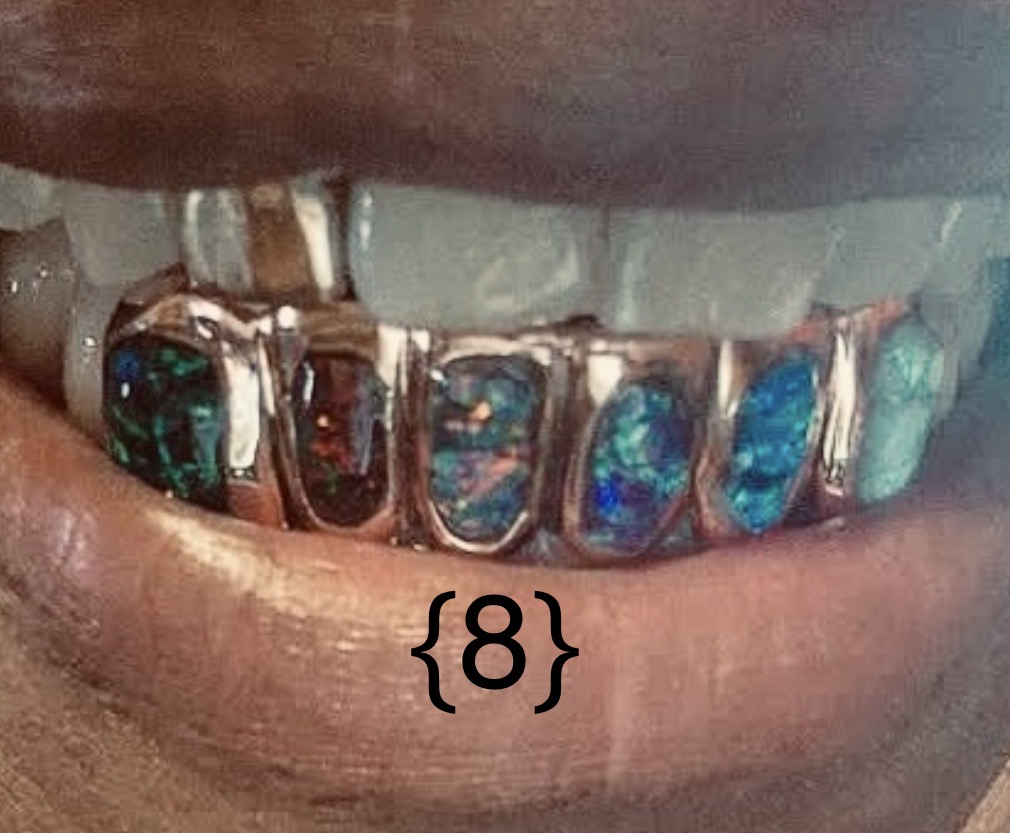Close-up of teeth with dental jewelry and a person's lips, showing a partial smile.