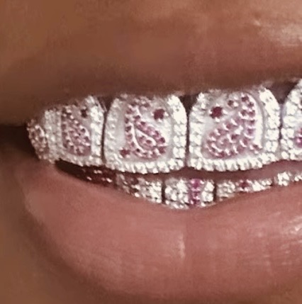 Close-up of a person's mouth showing teeth with diamond-encrusted dental jewelry, including a smiley face design.