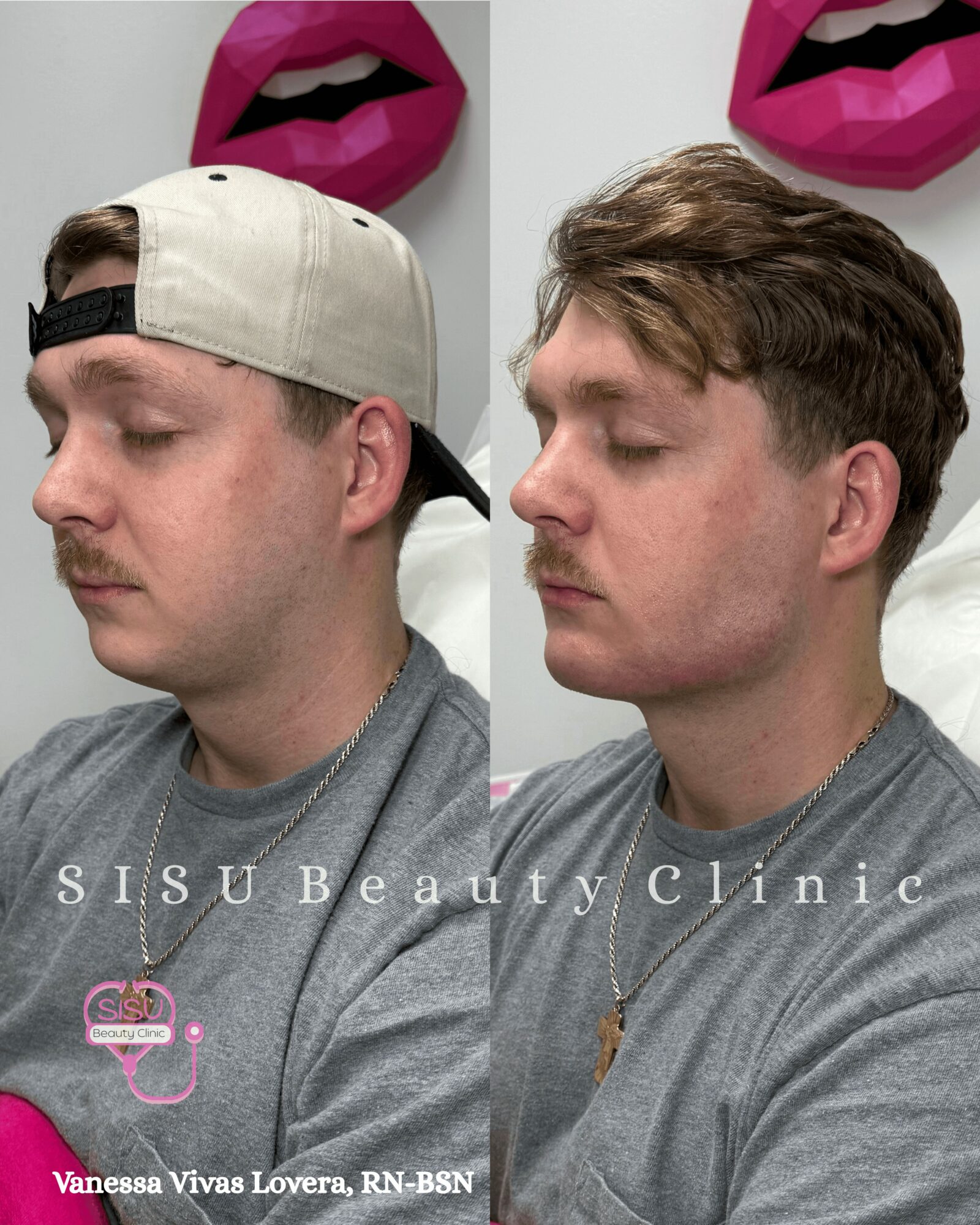 Side-by-side images of a man before and after a haircut, wearing a gray shirt, with pink lips artwork in background.