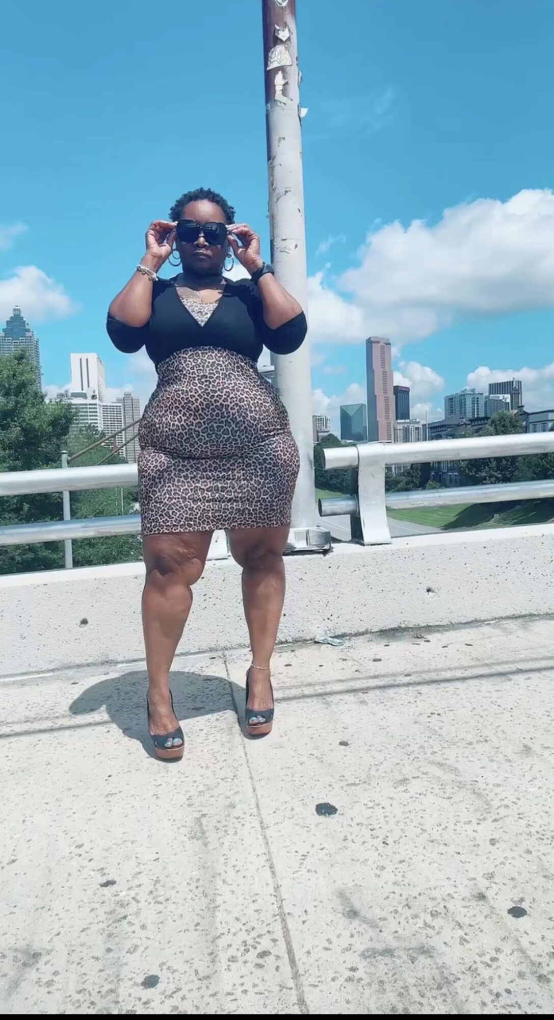 Woman in a patterned dress and sunglasses standing outdoors on a sunny day with city buildings in background.