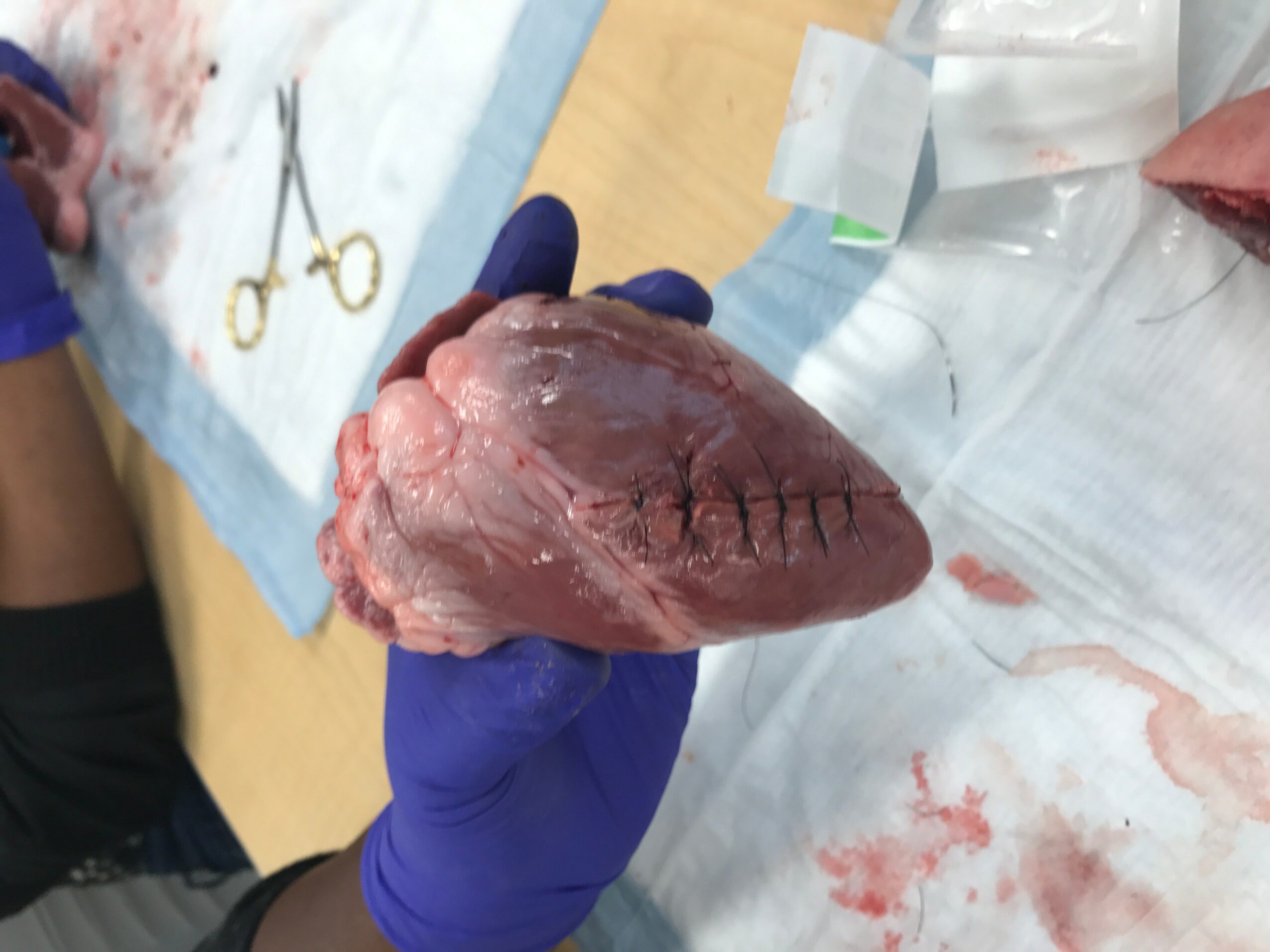Person wearing blue gloves holding a preserved animal heart with visible sutures, on a medical tray.