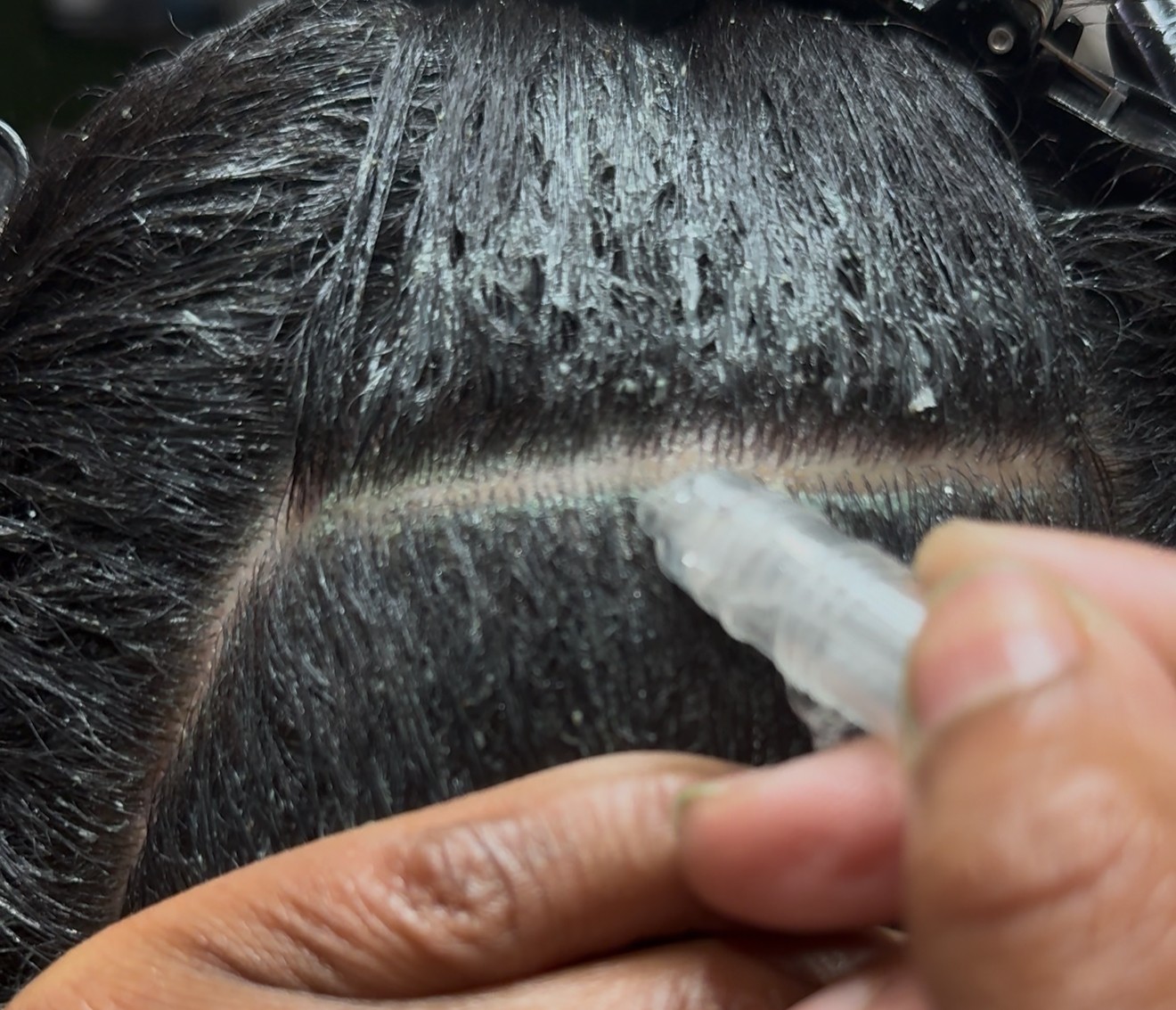 Person applying a substance to a person's hair with a small applicator, close-up view.