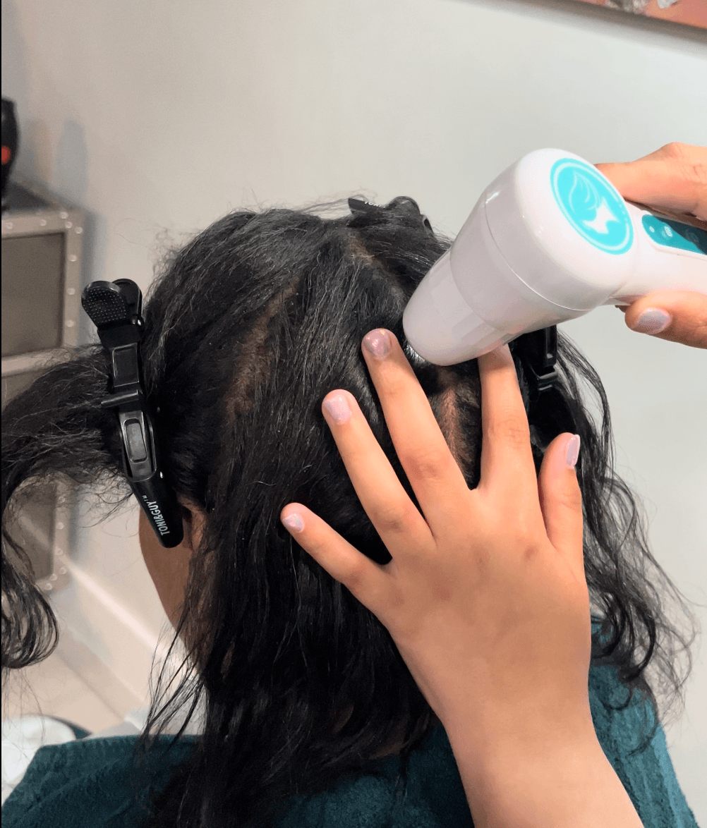 Child with dark hair held back by a clip receives a scalp treatment with a handheld device, hand on head, indoors.
