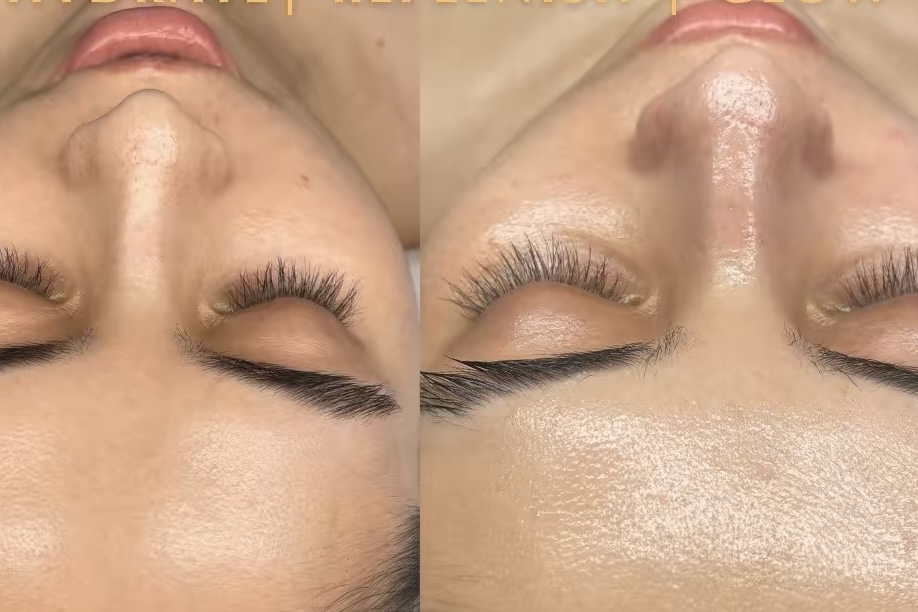 Close-up of a person's forehead and eyes with closed eyelids, showing skin texture and eyebrows, viewed from above.
